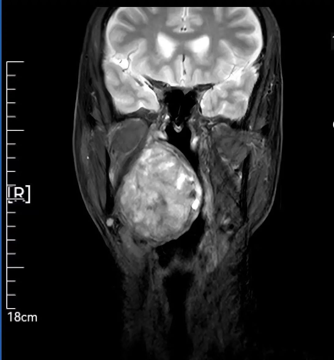 微信圖片_20250626152733.jpg 微信圖片_20250626152733.jpg